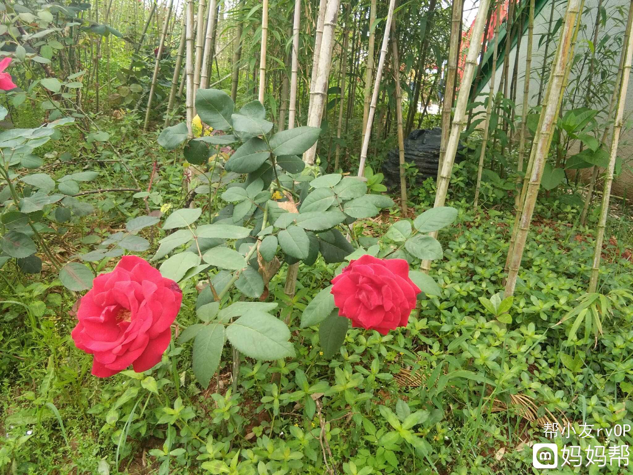 胚胎植入后生化妊娠的原因，四种情况易引发注意